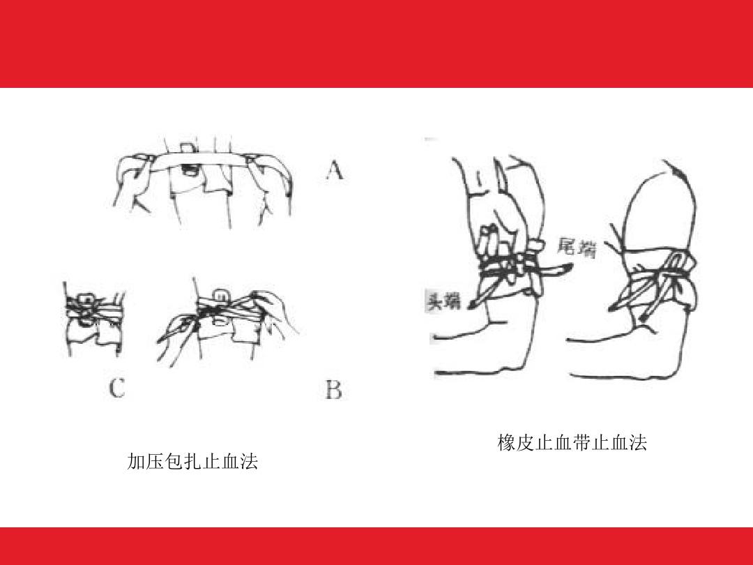 止血描述错误的是_下列关于止血的叙述正确的是_关于止血带下列描述正确的是