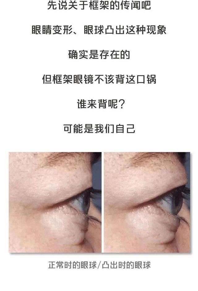 戴眼镜可以玩多久手机游戏_戴眼镜可以玩多久手机游戏_戴眼镜可以玩多久手机游戏
