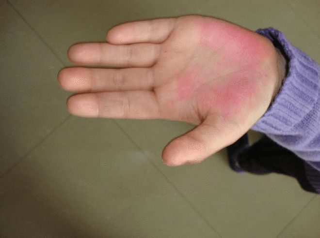 关于防疫停课不停学的通知_防疫停课手机游戏_防控疫情小游戏