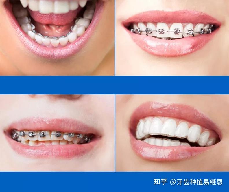 赛尔号钢牙鲨_钢牙_钢牙小鸡兵团