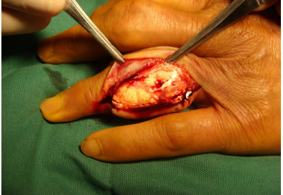 百度输入法下载的皮肤不见了_下载百度输入法_百度输入法键盘皮肤