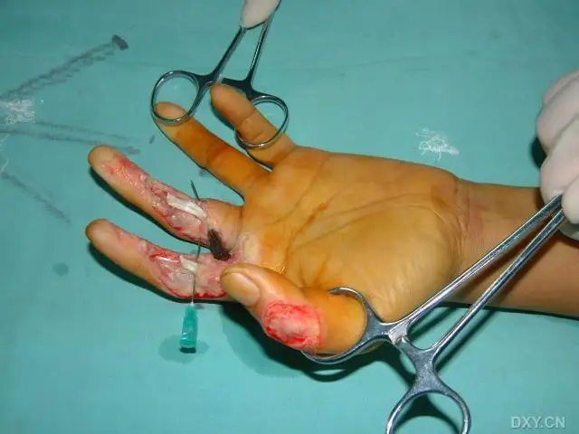 百度输入法键盘皮肤_下载百度输入法_百度输入法下载的皮肤不见了