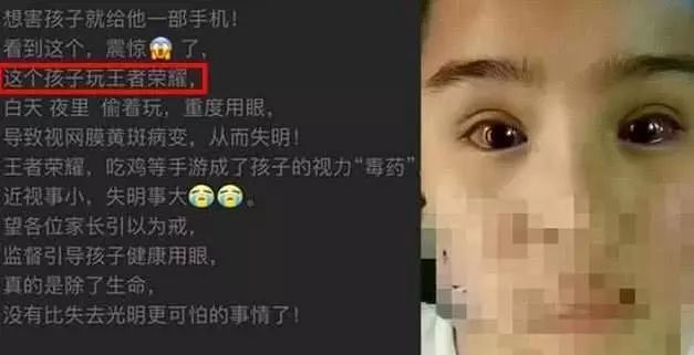 眼睛很久疼玩打手机游戏有用吗_眼睛玩手机疼痛如何缓解_打了很久游戏玩手机眼睛疼