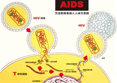 世界艾滋病日预防_世界预防艾滋病日_世界艾滋病的预防