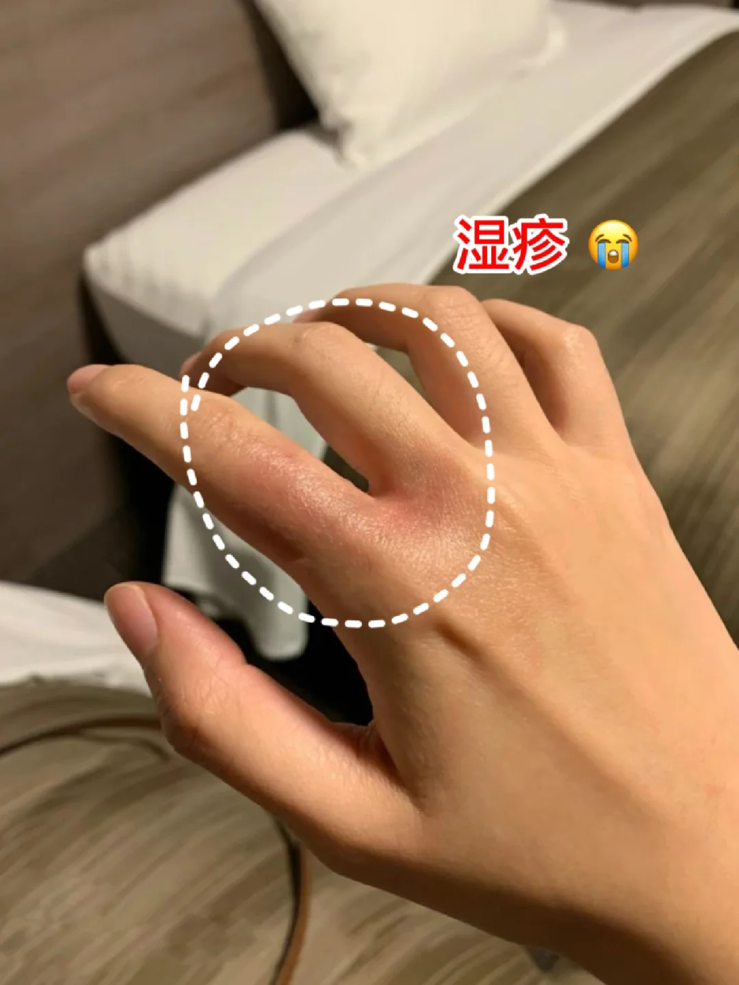 玩手机会出汗_冬天拿手机玩游戏手就出汗_手出汗玩手机很粘怎么解决
